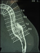 dentascanner-mandibulaire